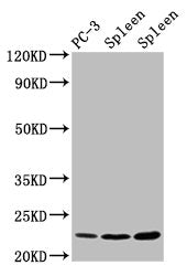 Western Blot Positive WB detected in: PC-3 whole cell lysate, Rat spleen tissue, Mouse spleen tissue All lanes: HIST1H1D antibody at 1.5µg/ml Secondary Goat polyclonal to rabbit IgG at 1/50000 dilution Predicted band size: 23 kDa Observed band siz...