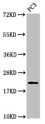 Western Blot Positive WB detected in: PC-3 whole cell lysate All lanes: HIST1H1D antibody at 1µg/ml Secondary Goat polyclonal to rabbit IgG at 1/50000 dilution Predicted band size: 23 kDa Observed band size: 23 kDa