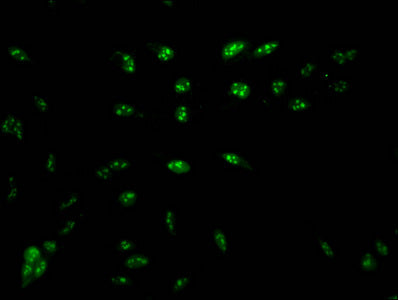 Immunofluorescent analysis of Hela cells using CSB-PA010379PA16nme1HU at dilution of 1:100 and Alexa Fluor 488-congugated AffiniPure Goat Anti-Rabbit IgG(H+L)