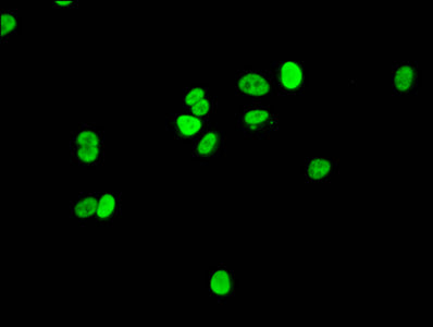 Immunofluorescence staining of MCF-7 cells with CSB-PA010380OA145phHU at 1:7.5, counter-stained with DAPI. The cells were fixed in 4% formaldehyde, permeabilized using 0.2% Triton X-100 and blocked in 10% normal Goat Serum. The cells were then inc...