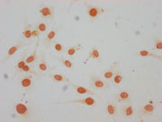 Immunocytochemistry analysis of CSB-PA010380OA147me1HU diluted at 1:15 and staining in Hela cells performed on a Leica BondTM system. The cells were fixed in 4% formaldehyde, permeabilized using 0.2% Triton X-100 and blocked with 10% normal goat s...