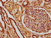 IHC image of CSB-PA010380OA147nme1HU diluted at 1:10 and staining in paraffin-embedded human kidney tissue performed on a Leica BondTM system. After dewaxing and hydration, antigen retrieval was mediated by high pressure in a citrate buffer (pH 6....