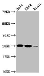 Western Blot Positive WB detected in: Hela whole cell lysate, K562 whole cell lysate, Rat brain tissue All lanes: HIST1H1E antibody at 1.48µg/ml Secondary Goat polyclonal to rabbit IgG at 1/50000 dilution Predicted band size: 22 kDa Observed band...