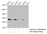 Western Blot Detected samples: Jurkat whole cell lysate, Hela whole cell lysate; Untreated (-) or treated (+) with Calyculin A and EGF All lanes: HIST1H1E antibody at 1:1000 Secondary Goat polyclonal to rabbit IgG at 1/40000 dilution Predicted ban...