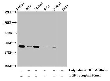 Western Blot Detected samples: Jurkat whole cell lysate, Hela whole cell lysate; Untreated (-) or treated (+) with Calyculin A and EGF All lanes: HIST1H1E antibody at 1:1000 Secondary Goat polyclonal to rabbit IgG at 1/40000 dilution Predicted ban...
