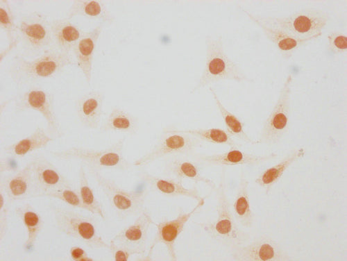 Immunocytochemistry analysis of CSB-PA010380OA25me1HU diluted at 1:20 and staining in Hela cells performed on a Leica BondTM system. The cells were fixed in 4% formaldehyde, permeabilized using 0.2% Triton X-100 and blocked with 10% normal goat se...