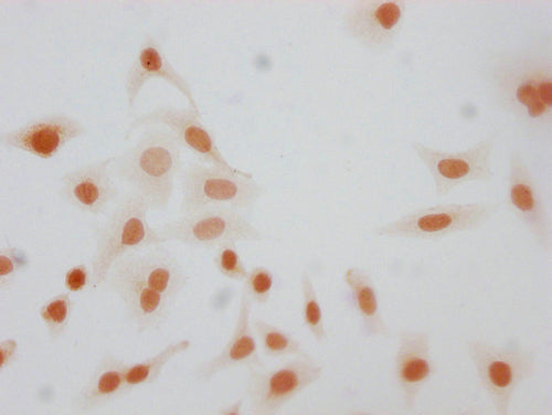 Immunocytochemistry analysis of CSB-PA010380OA26phHU diluted at 1:10 and staining in Hela cells(treated with 50nM Calyculin A for 30min) performed on a Leica BondTM system. The cells were fixed in 4% formaldehyde, permeabilized using 0.2% Triton X...