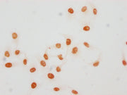 Immunocytochemistry analysis of CSB-PA010380OA45acHU diluted at 1:15 and staining in Hela cells(treated with 30mM sodium butyrate for 4h) performed on a Leica BondTM system. The cells were fixed in 4% formaldehyde, permeabilized using 0.2% Triton...