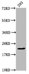 Western Blot Positive WB detected in: 293 whole cell lysate All lanes: HIST1H1E antibody at 0.94µg/ml Secondary Goat polyclonal to rabbit IgG at 1/50000 dilution Predicted band size: 22 kDa Observed band size: 22 kDa