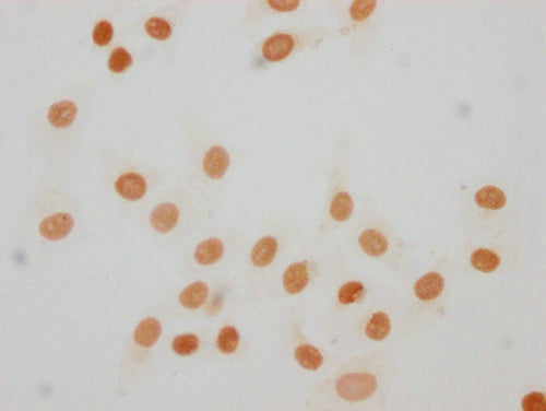 Immunocytochemistry analysis of CSB-PA010380OA63me1HU diluted at 1:30 and staining in Hela cells performed on a Leica BondTM system. The cells were fixed in 4% formaldehyde, permeabilized using 0.2% Triton X-100 and blocked with 10% normal goat se...