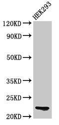 Western Blot Positive WB detected in: HEK293 whole cell lysate All lanes: HIST1H1E antibody at 0.1µg/ml Secondary Goat polyclonal to rabbit IgG at 1/50000 dilution Predicted band size: 22 kDa Observed band size: 22 kDa