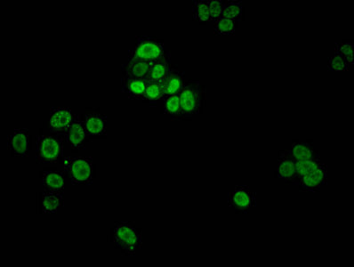 Immunofluorescent analysis of MCF-7 cells using CSB-PA010380PA03phHU at dilution of 1:100 and Alexa Fluor 488-congugated AffiniPure Goat Anti-Rabbit IgG(H+L)