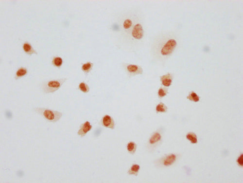 Immunocytochemistry analysis of CSB-PA010380PA145phHU diluted at 1:10 and staining in Hela cells(treated with 50nM Calyculin A for 30min) performed on a Leica BondTM system. The cells were fixed in 4% formaldehyde, permeabilized using 0.2% Triton...