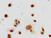 Immunocytochemistry analysis of MCF-7 cells using CSB-PA010380PA147me1HU at dilution of 1:100