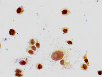 Immunocytochemistry analysis of MCF-7 cells using CSB-PA010380PA147me1HU at dilution of 1:100