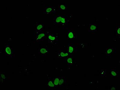 Immunofluorescent analysis of MCF-7 cells using CSB-PA010380PA147nme1HU at dilution of 1:100 and Alexa Fluor 488-congugated AffiniPure Goat Anti-Rabbit IgG(H+L)