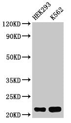 Western Blot Positive WB detected in: HEK293 whole cell lysate, K562 whole cell lysate All lanes: HIST1H1E antibody at 0.5µg/ml Secondary Goat polyclonal to rabbit IgG at 1/50000 dilution Predicted band size: 22 kDa Observed band size: 22 kDa