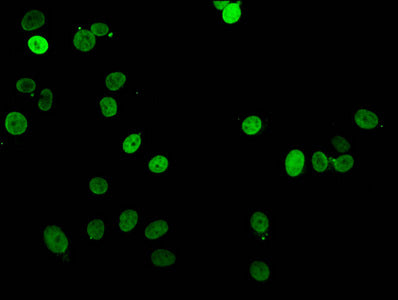 Immunofluorescent analysis of MCF-7 cells using CSB-PA010380PA16nme2HU at dilution of 1:100 and Alexa Fluor 488-congugated AffiniPure Goat Anti-Rabbit IgG(H+L)