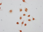 Immunocytochemistry analysis of CSB-PA010380PA17phHU diluted at 1:50 and staining in Hela cells(treated with 50nM Calyculin A for 30min) performed on a Leica BondTM system. The cells were fixed in 4% formaldehyde, permeabilized using 0.2% Triton X...