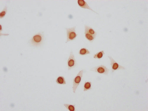 Immunocytochemistry analysis of CSB-PA010380PA17phHU diluted at 1:50 and staining in Hela cells(treated with 50nM Calyculin A for 30min) performed on a Leica BondTM system. The cells were fixed in 4% formaldehyde, permeabilized using 0.2% Triton X...