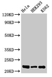 Western Blot Positive WB detected in: Hela whole cell lysate, HEK293 whole cell lysate, K562 whole cell lysate All lanes: HIST1H1E antibody at 0.5µg/ml Secondary Goat polyclonal to rabbit IgG at 1/50000 dilution Predicted band size: 22 kDa Observe...