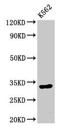 Western Blot Positive WB detected in: K562 whole cell lysate All lanes: HIST1H1E antibody at 0.5µg/ml Secondary Goat polyclonal to rabbit IgG at 1/50000 dilution Predicted band size: 22 kDa Observed band size: 32 kDa