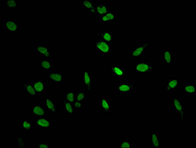 Immunofluorescent analysis of Hela cells using CSB-PA010380PA35nphHU at dilution of 1:100 and Alexa Fluor 488-congugated AffiniPure Goat Anti-Rabbit IgG(H+L)