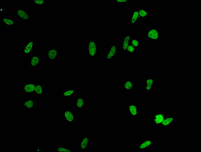 Immunofluorescent analysis of Hela cells using CSB-PA010380PA51nacHU at dilution of 1:100 and Alexa Fluor 488-congugated AffiniPure Goat Anti-Rabbit IgG(H+L)