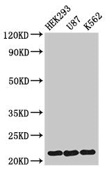 Western Blot Positive WB detected in: HEK293 whole cell lysate, U87 whole cell lysate, K562 whole cell lysate All lanes: HIST1H1E antibody at 1.5µg/ml Secondary Goat polyclonal to rabbit IgG at 1/50000 dilution Predicted band size: 22 kDa Observed...