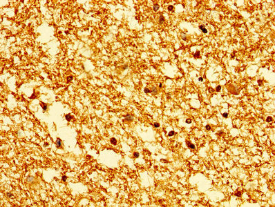 Immunohistochemistry of paraffin-embedded human brain tissue using CSB-PA010380PA63nme1HU at dilution of 1:100