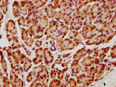 IHC image of CSB-PA010385HA01HU diluted at 1:1300 and staining in paraffin-embedded human pancreatic tissue performed on a Leica BondTM system. After dewaxing and hydration, antigen retrieval was mediated by high pressure in a citrate buffer (pH 6...