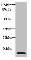 Western blot All lanes: HIST1H2AG antibody at 4µg/ml + HL60 whole cell lysate Secondary Goat polyclonal to rabbit IgG at 1/10000 dilution Predicted band size: 15 kDa Observed band size: 15 kDa