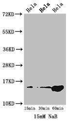 Western Blot Positive WB detected in: Hela cell acid extracts treated by NaB All lanes: HIST1H2AG antibody at 1.5µg/ml Secondary Goat polyclonal to rabbit IgG at 1/50000 dilution Predicted band size: 15 kDa Observed band size: 15 kDa