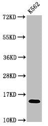 Western Blot Positive WB detected in: K562 cell acid extracts All lanes: HIST1H2AG antibody at 0.75µg/ml Secondary Goat polyclonal to rabbit IgG at 1/50000 dilution Predicted band size: 15 kDa Observed band size: 15 kDa