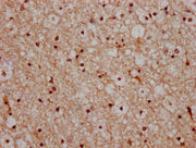 IHC image of CSB-PA010389OA05nbhbHU diluted at 1:20 and staining in paraffin-embedded human brain tissue performed on a Leica BondTM system. After dewaxing and hydration, antigen retrieval was mediated by high pressure in a citrate buffer (pH 6.0)...