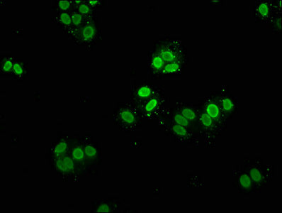 Immunofluorescence staining of Hela cells with CSB-PA010389OA09me1HU at 1:5, counter-stained with DAPI. The cells were fixed in 4% formaldehyde, permeabilized using 0.2% Triton X-100 and blocked in 10% normal Goat Serum. The cells were then incuba...