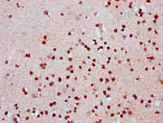 IHC image of CSB-PA010389OA118nhibHU diluted at 1:20 and staining in paraffin-embedded human brain tissue performed on a Leica BondTM system. After dewaxing and hydration, antigen retrieval was mediated by high pressure in a citrate buffer (pH 6.0...