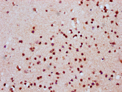 IHC image of CSB-PA010389OA118nhibHU diluted at 1:20 and staining in paraffin-embedded human brain tissue performed on a Leica BondTM system. After dewaxing and hydration, antigen retrieval was mediated by high pressure in a citrate buffer (pH 6.0...