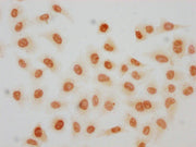 Immunocytochemistry analysis of CSB-PA010389OA119crHU diluted at 1:100 and staining in Hela cells(treated with 30mM sodium crotonylate for 4h) performed on a Leica BondTM system. The cells were fixed in 4% formaldehyde, permeabilized using 0.2% Tr...