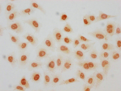 Immunocytochemistry analysis of CSB-PA010389OA119crHU diluted at 1:100 and staining in Hela cells(treated with 30mM sodium crotonylate for 4h) performed on a Leica BondTM system. The cells were fixed in 4% formaldehyde, permeabilized using 0.2% Tr...