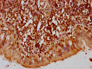 IHC image of CSB-PA010389OA119nbhbHU diluted at 1:10 and staining in paraffin-embedded human lung tissue performed on a Leica BondTM system. After dewaxing and hydration, antigen retrieval was mediated by high pressure in a citrate buffer (pH 6.0)...