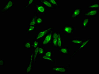 Immunofluorescence staining of Hela cells with CSB-PA010389OA11me2HU at 1:2.5, counter-stained with DAPI. The cells were fixed in 4% formaldehyde, permeabilized using 0.2% Triton X-100 and blocked in 10% normal Goat Serum. The cells were then incu...
