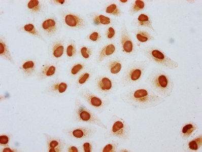 Immunocytochemistry analysis of CSB-PA010389OA15acHU diluted at 1:3 and staining in Hela cells (treated with 30mM sodium butyrate for 4h) performed on a Leica BondTM system. The cells were fixed in 4% formaldehyde, permeabilized using 0.2% Triton...