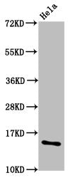 Western Blot Positive WB detected in: Hela whole cell lysate (treated with 30mM sodium butyrate for 4h) All lanes: HIST1H2AG antibody at 1.5µg/ml Secondary Goat polyclonal to rabbit IgG at 1/50000 dilution Predicted band size: 15 kDa Observed band...