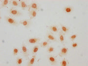 Immunocytochemistry analysis of CSB-PA010389OA36crHU diluted at 1:50 and staining in Hela cells(treated with 30mM sodium crotonylate for 4h) performed on a Leica BondTM system. The cells were fixed in 4% formaldehyde, permeabilized using 0.2% Trit...