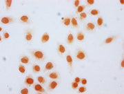 Immunocytochemistry analysis of CSB-PA010389OA36hibHU diluted at 1:20 and staining in Hela cells (treated with 30mM sodium butyrate for 4h) performed on a Leica BondTM system. The cells were fixed in 4% formaldehyde, permeabilized using 0.2% Trito...