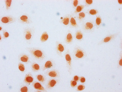 Immunocytochemistry analysis of CSB-PA010389OA36hibHU diluted at 1:20 and staining in Hela cells (treated with 30mM sodium butyrate for 4h) performed on a Leica BondTM system. The cells were fixed in 4% formaldehyde, permeabilized using 0.2% Trito...