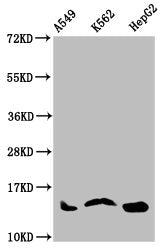 Western Blot Positive WB detected in: A549 whole cell lysate, K562 whole cell lysate, HepG2 whole cell lysate All lanes: HIST1H2AG antibody at 1µg/ml Secondary Goat polyclonal to rabbit IgG at 1/50000 dilution Predicted band size: 15 kDa Observed...