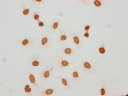 Immunocytochemistry analysis of CSB-PA010389PA05hibHU diluted at 1:150 and staining in Hela cells(treated with 30mM sodium butyrate for 4h) performed on a Leica BondTM system. The cells were fixed in 4% formaldehyde, permeabilized using 0.2% Trito...
