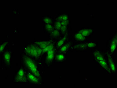 Immunofluorescent analysis of Hela cells using CSB-PA010389PA05nacHU at dilution of 1:100 and Alexa Fluor 488-congugated AffiniPure Goat Anti-Rabbit IgG(H+L)